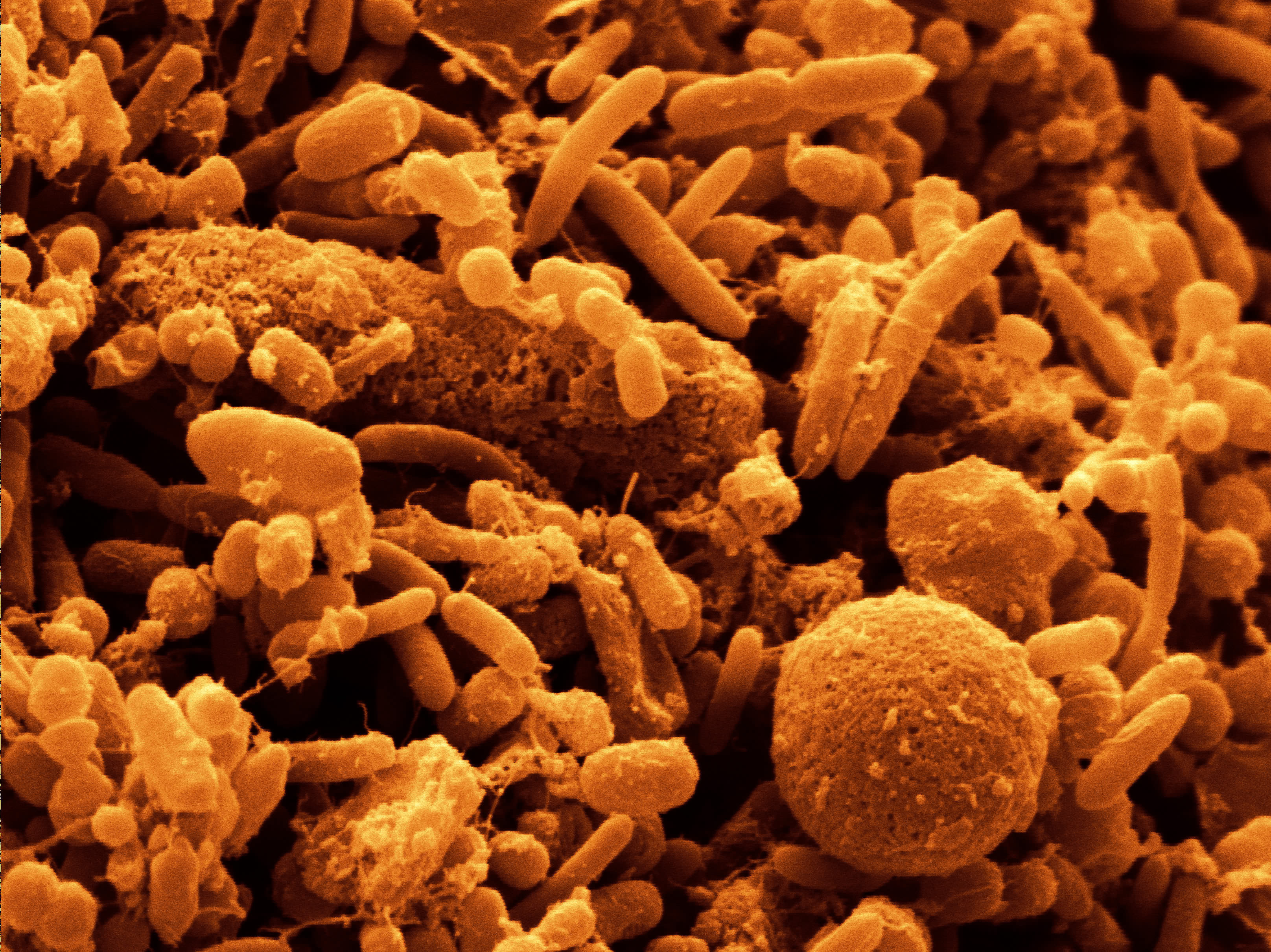 Разрушающие микроорганизмы. Микробиота бактерии грибки. Бактерии под микроскопом. Микроорганизмы под микроскопом. Микробы в микроскопе.